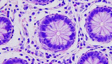 Experimental Chemo Drug May Trick the Immune System Into Fighting Cancer - UT Austin News