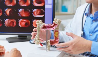 As colon cancer rises in younger adults, D-FW scientists uncover crucial clue