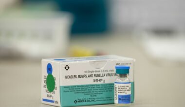 136 measles cases reported in Texas so far this year