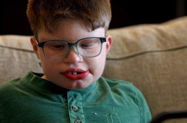 Luke Lunday, 12, was born with a rare genetic syndrome that requires additional support to live at home. A Texas lawsuit is threatening Luke's right to receive these services at home.