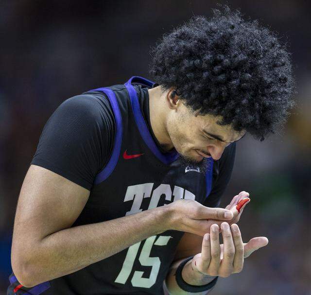 TCU forward David Punch (15) comes out of the game bloody in the first half against Duke on Saturday during the second round of the NCAA Tournament at Bon Secours Arena in Greenville, S.C.