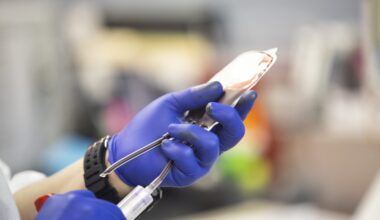 Blood Donations Urgently Needed After Sixth Street Shooting • The Austin Chronicle