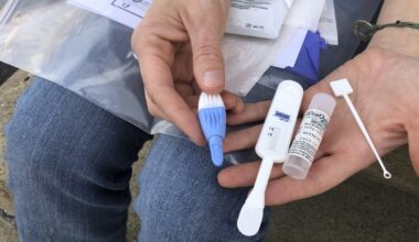 Dallas has one of the highest HIV rates in Texas. Three nonprofits received grants to fight that