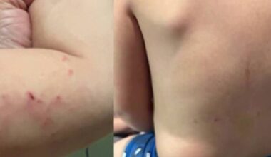 Houston mom says 3-year-old came home with scratches, bruises after 4 days at Whiz Children’s Academy