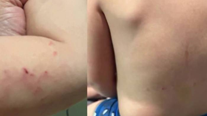 Houston mom says 3-year-old came home with scratches, bruises after 4 days at Whiz Children’s Academy