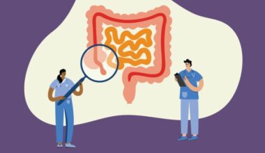 3 reasons appendix cancer is hard to diagnose