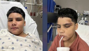 San Antonio doctors team up with Fresh Start to deliver life-changing reconstructive surgeries for kids