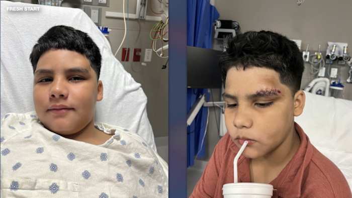 San Antonio doctors team up with Fresh Start to deliver life-changing reconstructive surgeries for kids