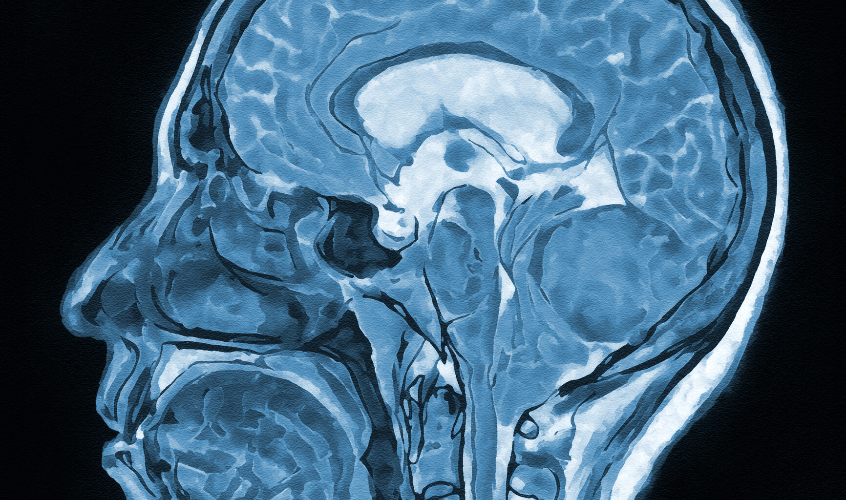 Cocaine rewires brain to reinforce addiction, UT Dallas study finds