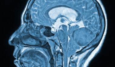 Cocaine rewires brain to reinforce addiction, UT Dallas study finds