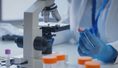 Houston leads Texas in tuberculosis rates, new report finds