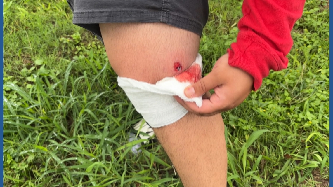 Victim speaks out after being injured in shooting after suspect's arrest
