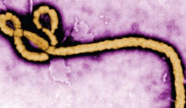 Harris County officials say World Cup events remain low risk amid Ebola monitoring