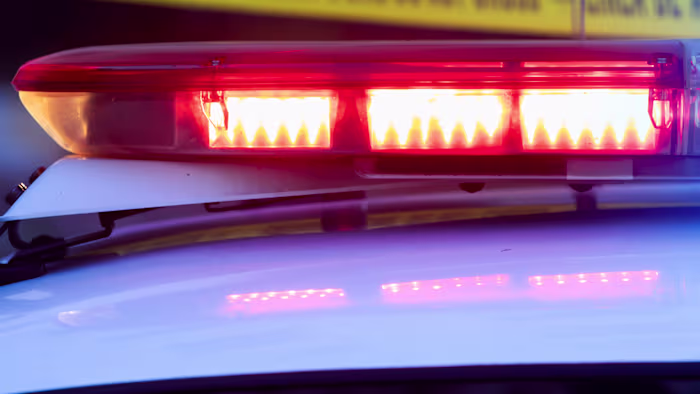 Shots fired at service dog while protecting owner from aggressive pit bull, deputies say