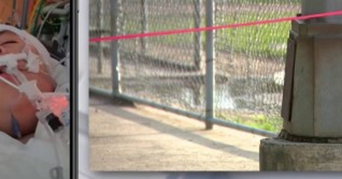14-year-old boy hospitalized after being shocked by light pole at SE Houston park