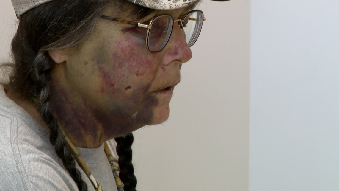 Woman suffers brutal attack during solo protest on Texas overpass