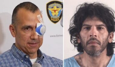 Fort Worth CRU officer reflects on neighborhood shooting that left his eye injured