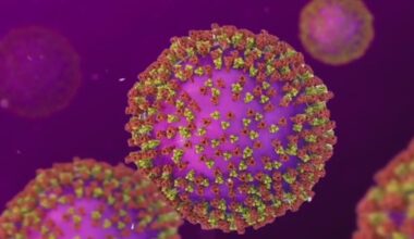 Measles case reported in Travis County; first for 2026