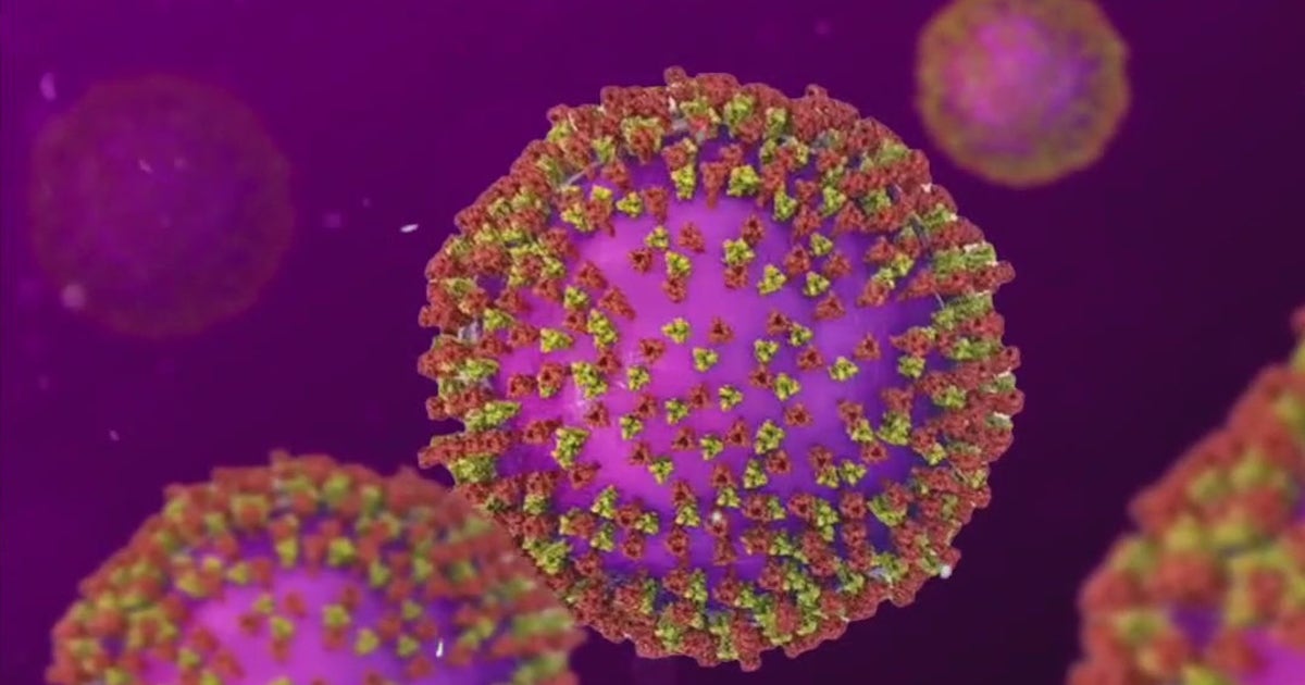 Measles case reported in Travis County; first for 2026