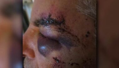 Knicks fan says father was ‘lying in a pool of his own blood’ after assault outside River Walk hotel