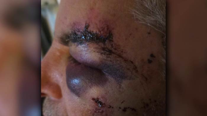 Knicks fan says father was ‘lying in a pool of his own blood’ after assault outside River Walk hotel