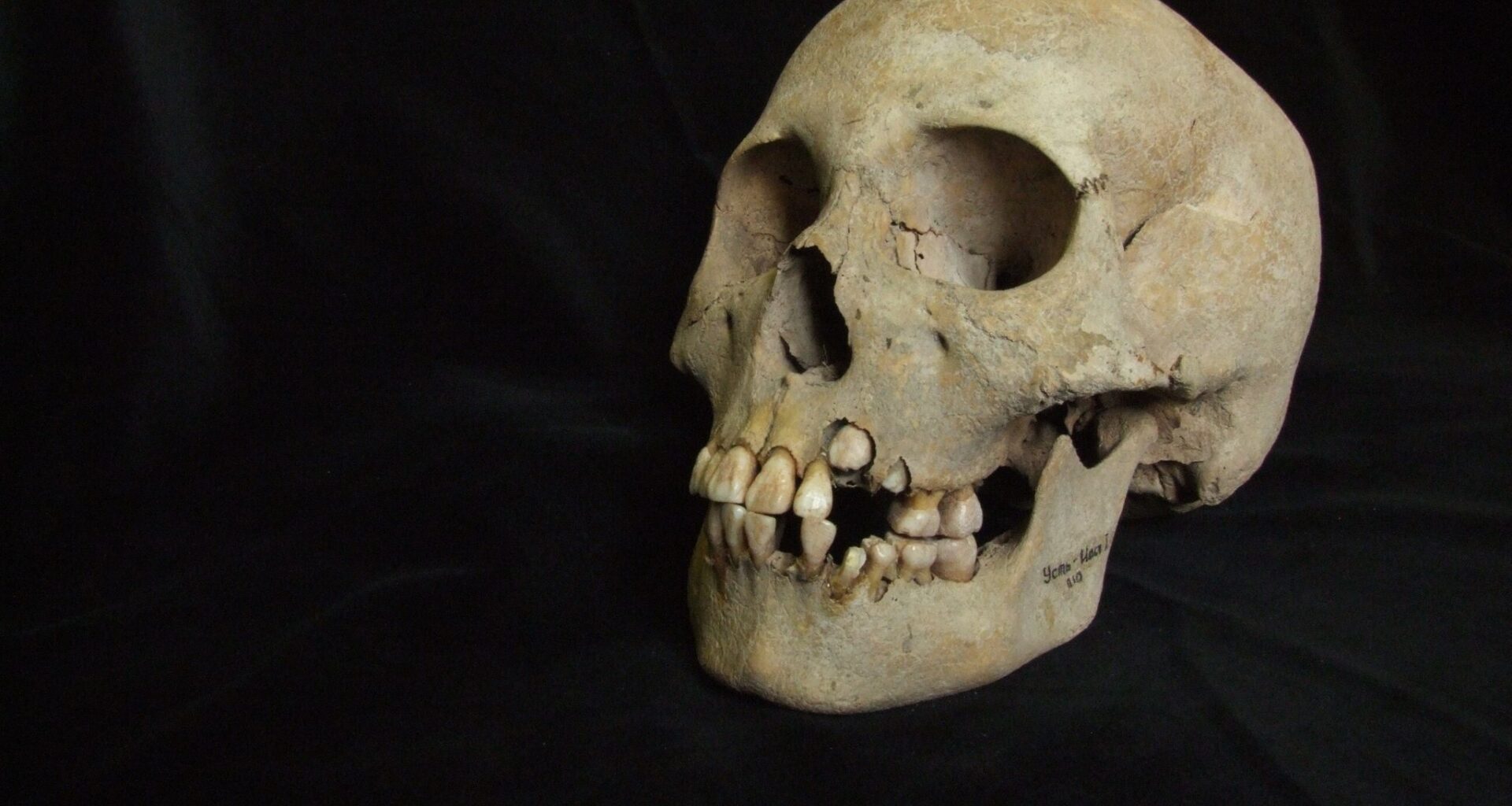 Ancient teeth from Siberia rewrite the plague’s timeline, dating back to over 5,500 years ago