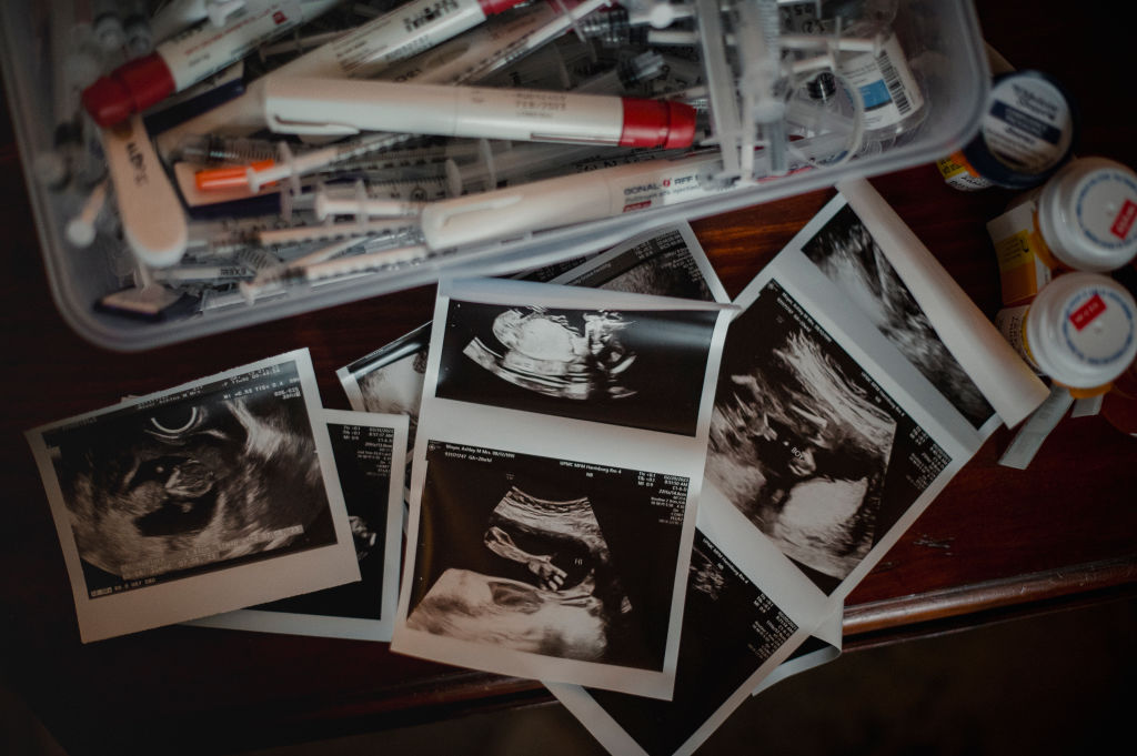 Texas GOP moves to end IVF in shocking platform push