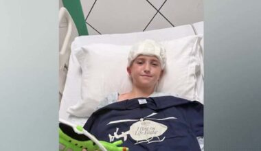 Teen survives traumatic brain injury after e-scooter crash, urges others to wear helmets