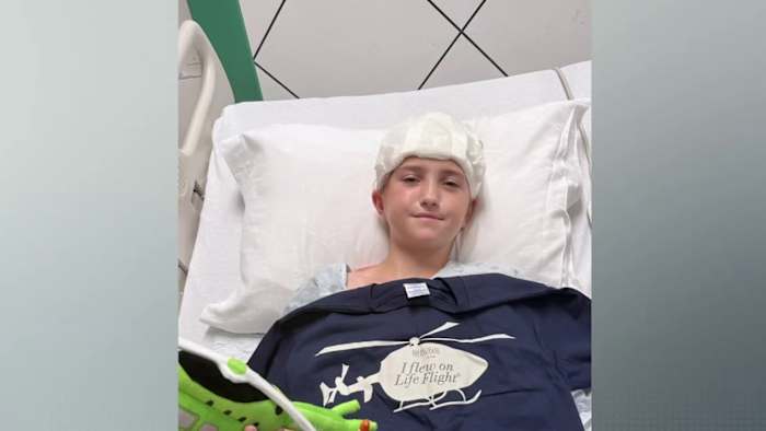Teen survives traumatic brain injury after e-scooter crash, urges others to wear helmets
