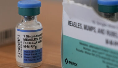 CT reports 2nd measles case of 2026 in vaccinated adult