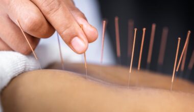 acupuncture needles in a back
