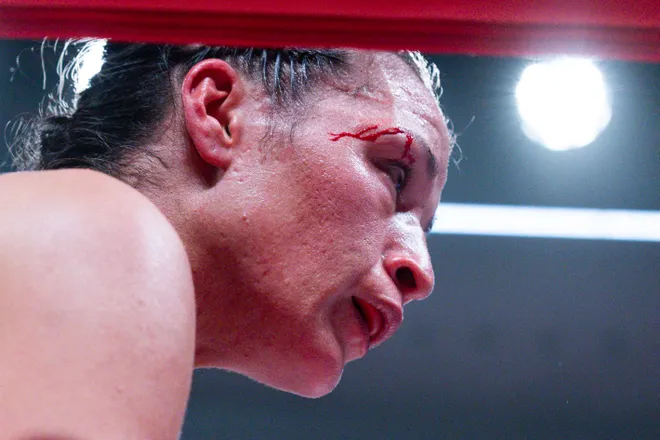 El Paso boxer Stephanie Han has a cut above her eye during her WBA lightweight world championship bout against Albuquerque boxer Holly Holm Saturday, May 30, 2026, at the El Paso County Coliseum in El Paso, Texas.