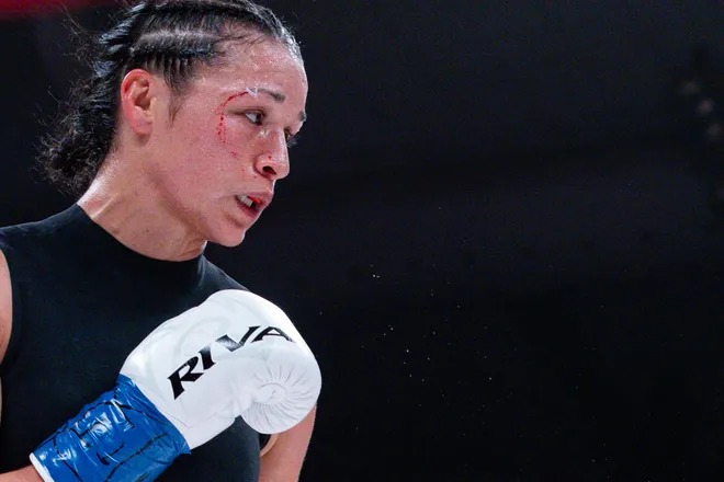 El Paso boxer Stephanie Han has a cut above her eye during her WBA lightweight world championship bout against Albuquerque boxer Holly Holm Saturday, May 30, 2026, at the El Paso County Coliseum in El Paso, Texas.