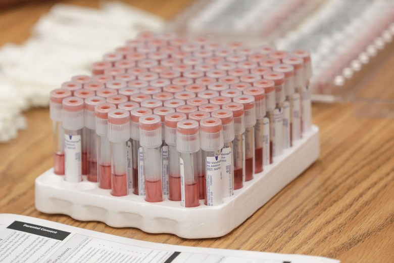 Infection rates are in decline, but that doesn't mean the coronavirus isn't still widespread in the community, local health officials said.