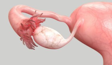 Should you have your fallopian tubes removed to prevent ovarian cancer?