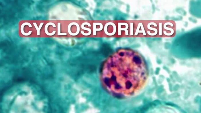 What is Cyclospora cayetanensis? CDC reports parasite causing stomach illness across US, including Texas