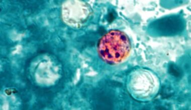 Nueces County has most parasitic diarrhea cases reported in Texas