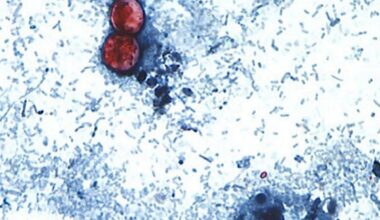 Most healthy people will eventually recover from cyclosporiasis without treatment although their illness may be prolonged.