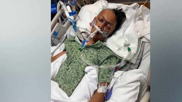 Family demands justice after man on life support after brutal attack along Highway 249