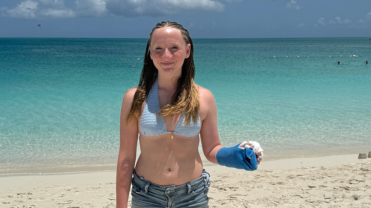 Barracuda attacks Texas teen, badly injures her hand in Turks and Caicos vacation spot