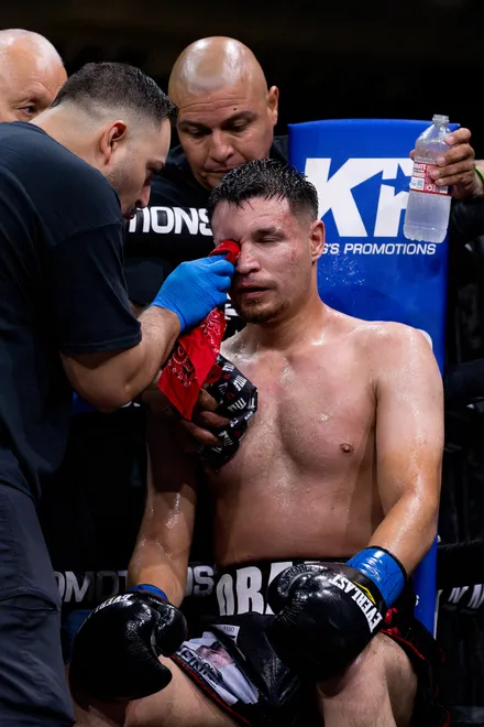 El Paso junior middleweight Victor Aranda receives treatment for a cut above his left eye in his corner during Kings Promotions' Ring Wars 23 at the El Paso County Coliseum on Saturday, July 18, 2026.