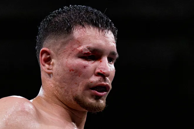 El Paso junior middleweight Victor Aranda fights with a cut above his left eye during his bout against New Mexico's Elija Martinez at Kings Promotions' Ring Wars 23 at the El Paso County Coliseum on Saturday, July 18, 2026.