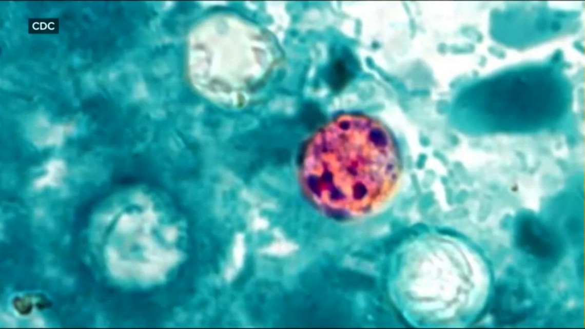 Cyclospora cases climb in Nueces County as local doctor explains how to stay safe