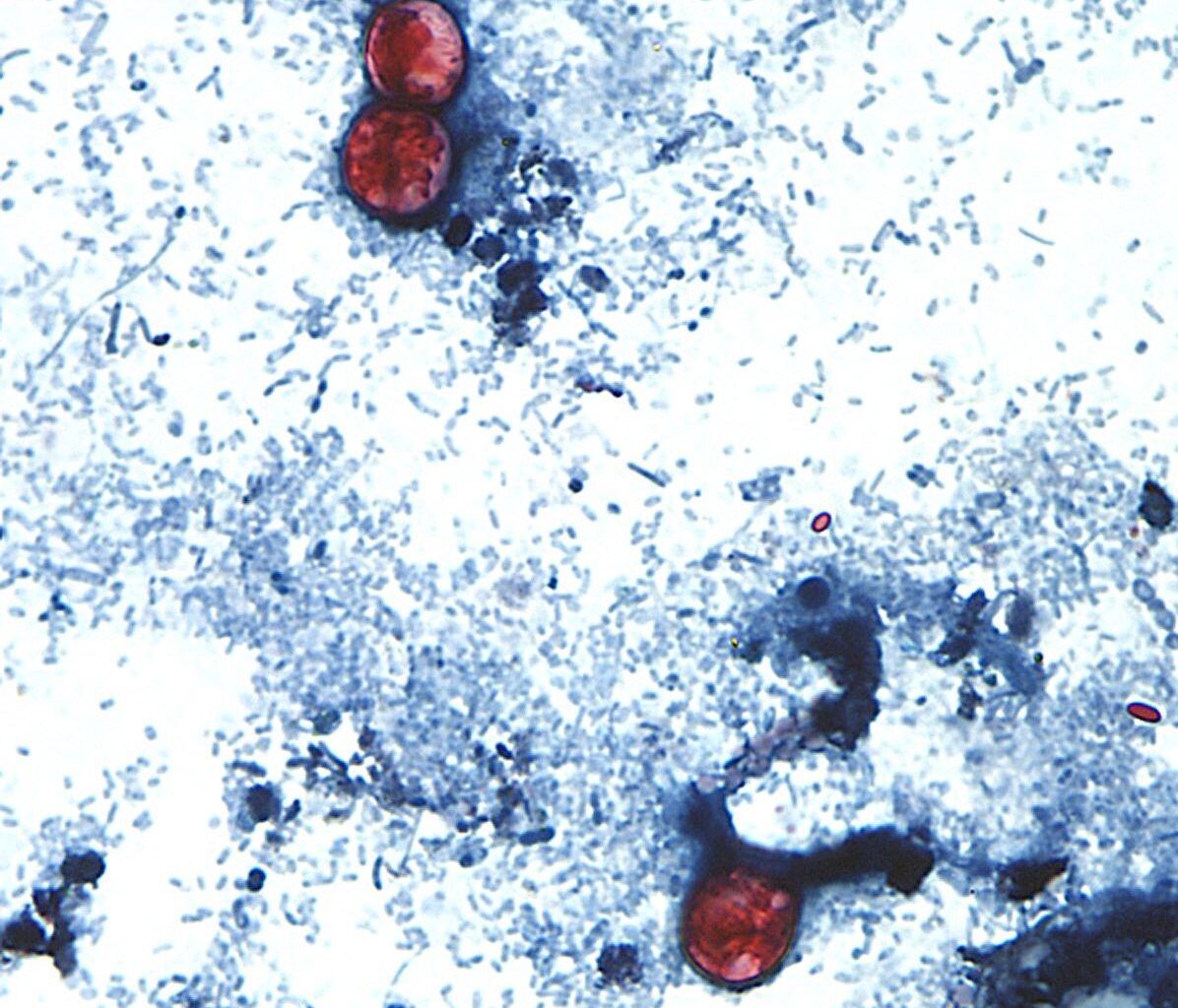 Parasite causing explosive diarrhea found in El Paso during multistate outbreak