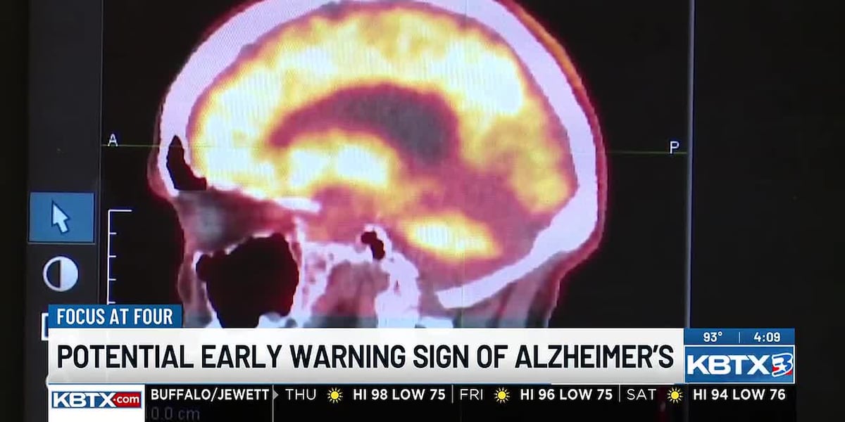 Texas A&M research finds earlier Alzheimer’s warning sign
