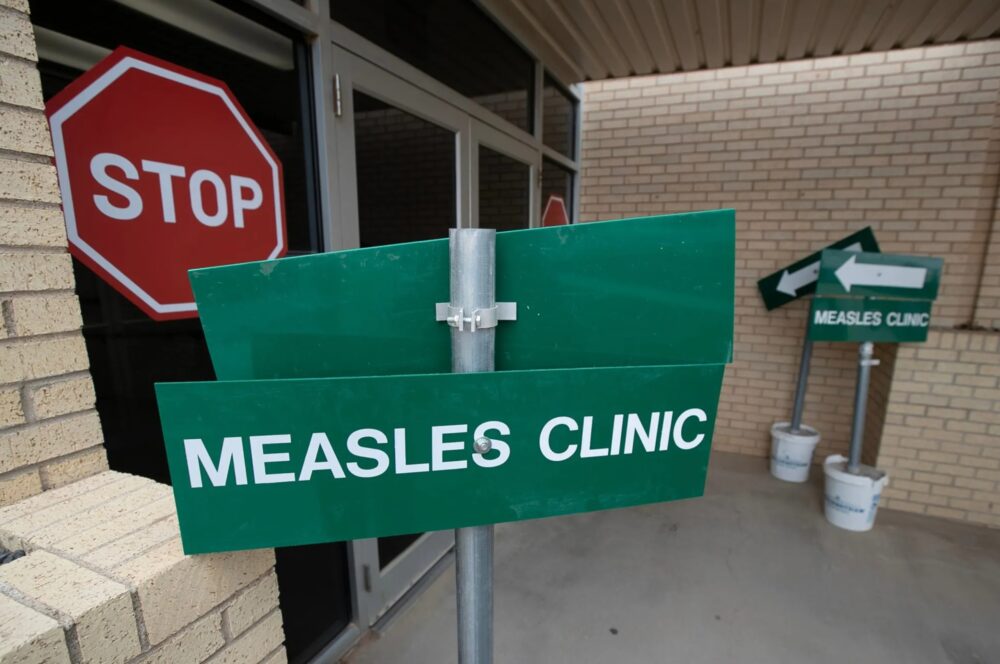 Measles Clinic Andrews Texas