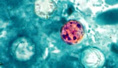 ‘Explosive’ diarrhea illness uptick reported in Texas, 16 other states