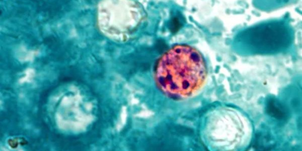‘Explosive’ diarrhea illness uptick reported in Texas, 16 other states
