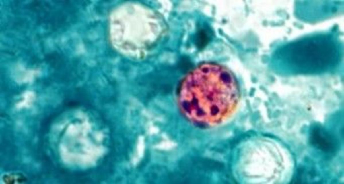 What Is Cyclospora And Why Does Texas See So Many Cases