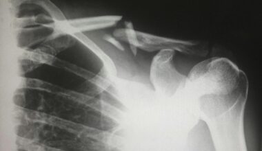 Why Summer Sends More Kids To The ER Every Year